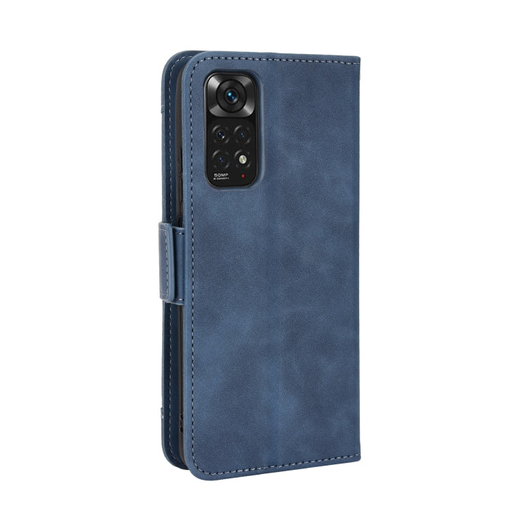 For Xiaomi Redmi Note 11S / Note 11 4G Overseas Version Skin Feel Calf Pattern Leather Phone Case