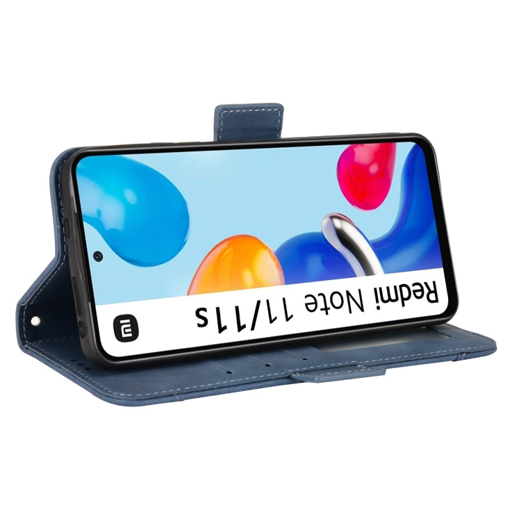 For Xiaomi Redmi Note 11S / Note 11 4G Overseas Version Skin Feel Calf Pattern Leather Phone Case