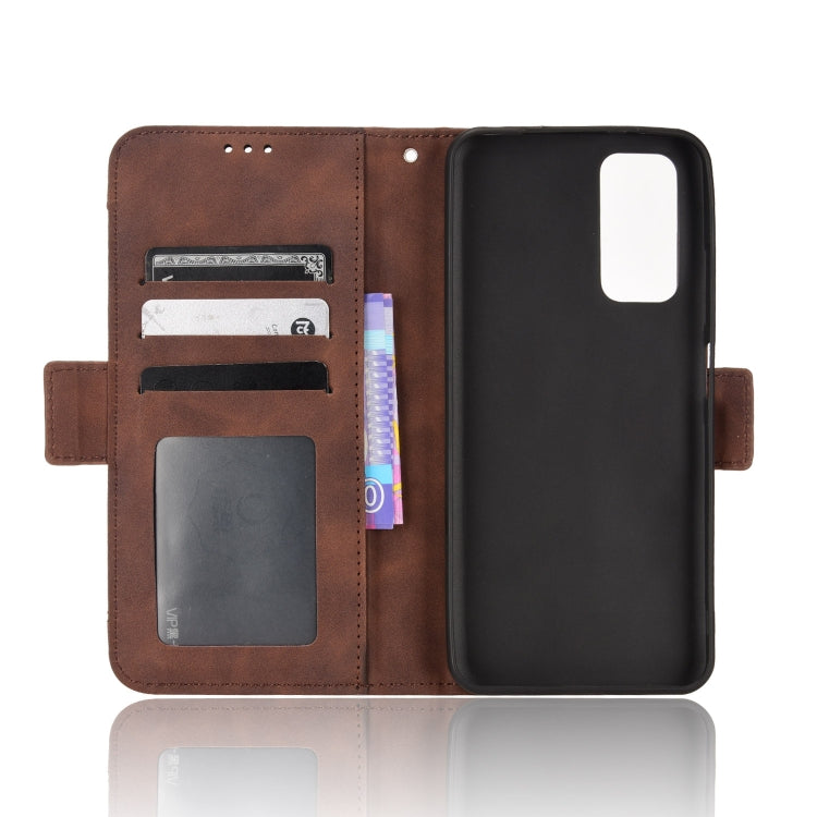 For Xiaomi Redmi Note 11S / Note 11 4G Overseas Version Skin Feel Calf Pattern Leather Phone Case