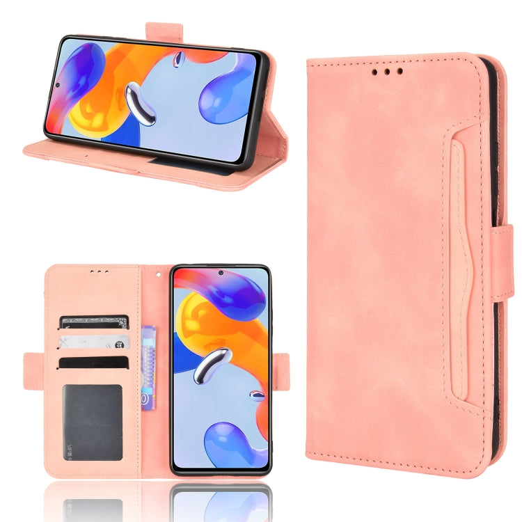 For Xiaomi Redmi Note 11 Pro 4G / 5G Overseas Version Skin Feel Calf Pattern Leather Phone Case