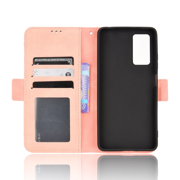 For Xiaomi Redmi Note 11 Pro 4G / 5G Overseas Version Skin Feel Calf Pattern Leather Phone Case