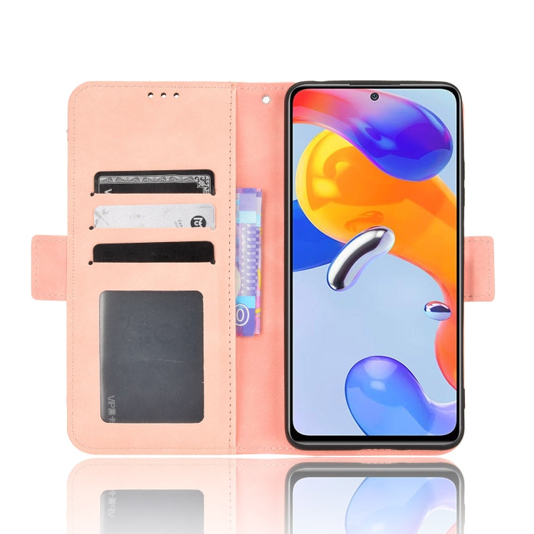 For Xiaomi Redmi Note 11 Pro 4G / 5G Overseas Version Skin Feel Calf Pattern Leather Phone Case
