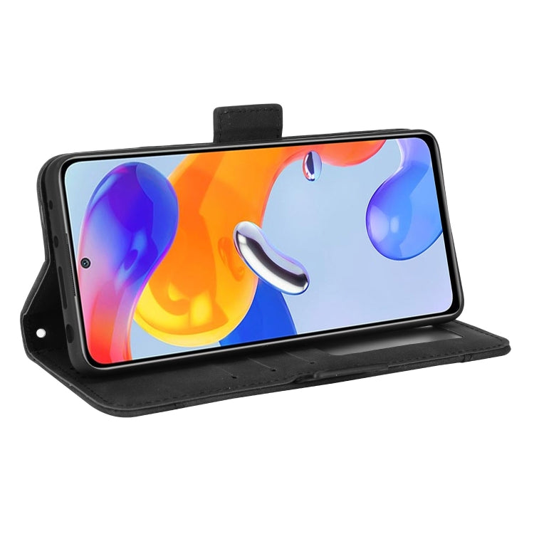 For Xiaomi Redmi Note 11 Pro 4G / 5G Overseas Version Skin Feel Calf Pattern Leather Phone Case