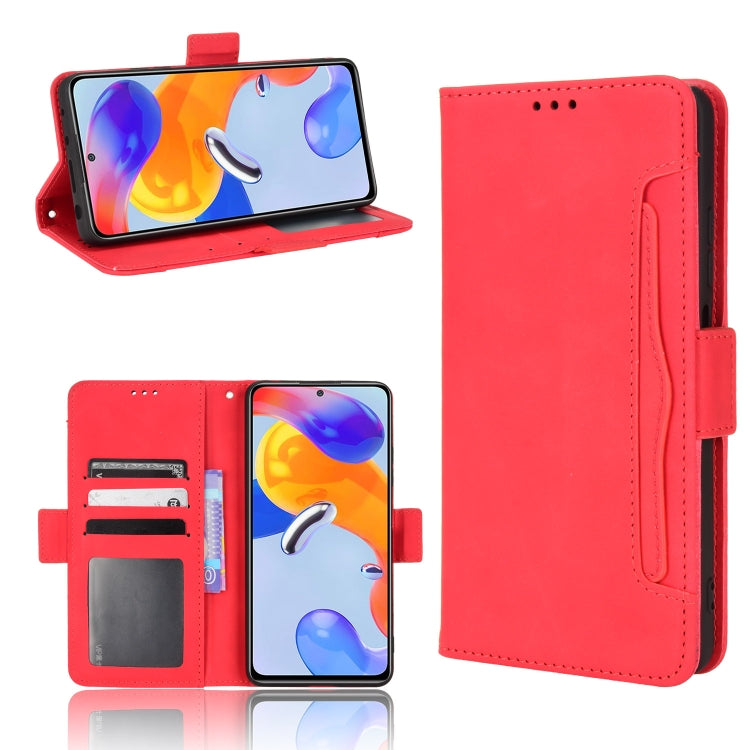 For Xiaomi Redmi Note 11 Pro 4G / 5G Overseas Version Skin Feel Calf Pattern Leather Phone Case