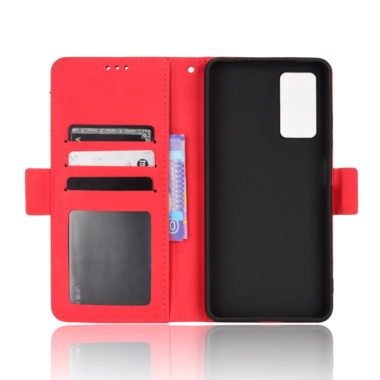 For Xiaomi Redmi Note 11 Pro 4G / 5G Overseas Version Skin Feel Calf Pattern Leather Phone Case