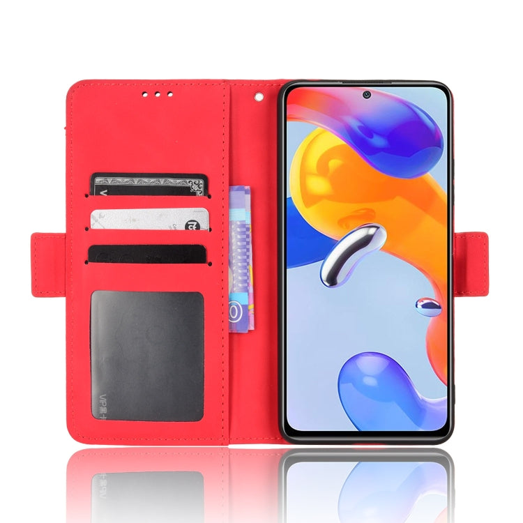 For Xiaomi Redmi Note 11 Pro 4G / 5G Overseas Version Skin Feel Calf Pattern Leather Phone Case