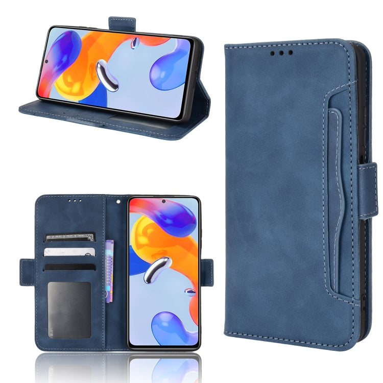 For Xiaomi Redmi Note 11 Pro 4G / 5G Overseas Version Skin Feel Calf Pattern Leather Phone Case