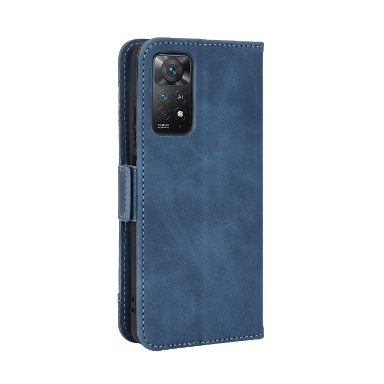 For Xiaomi Redmi Note 11 Pro 4G / 5G Overseas Version Skin Feel Calf Pattern Leather Phone Case