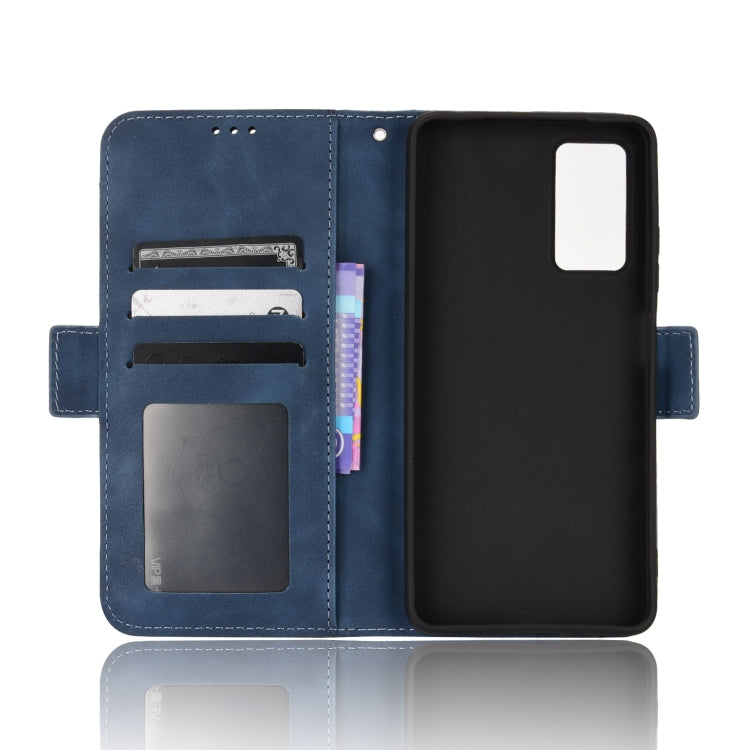 For Xiaomi Redmi Note 11 Pro 4G / 5G Overseas Version Skin Feel Calf Pattern Leather Phone Case