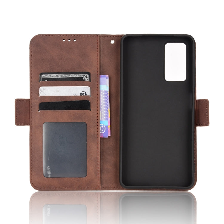 For Xiaomi Redmi Note 11 Pro 4G / 5G Overseas Version Skin Feel Calf Pattern Leather Phone Case