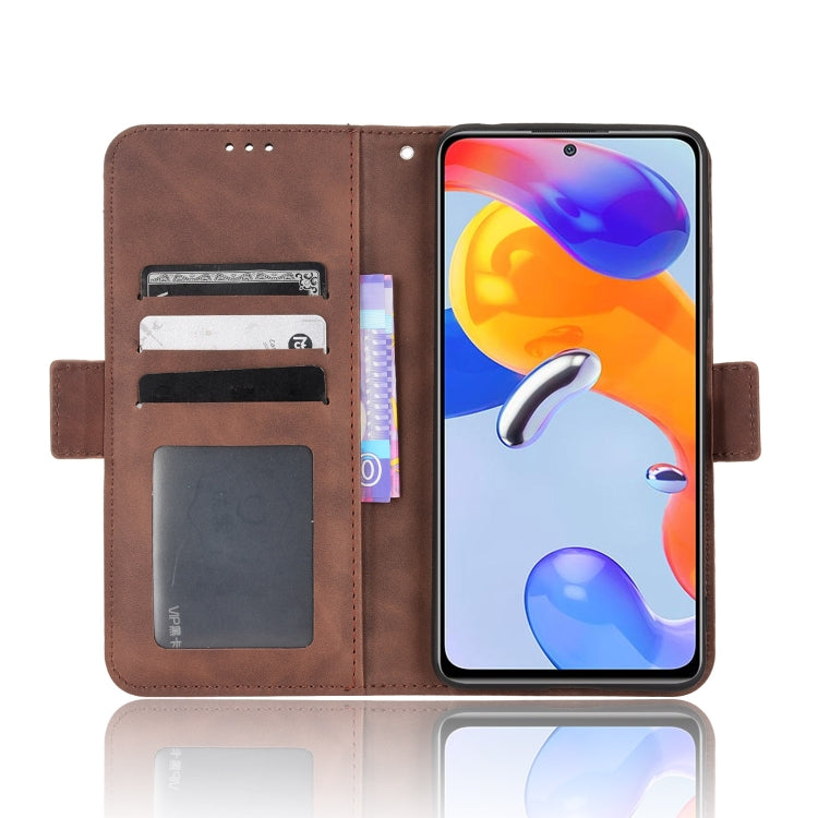 For Xiaomi Redmi Note 11 Pro 4G / 5G Overseas Version Skin Feel Calf Pattern Leather Phone Case