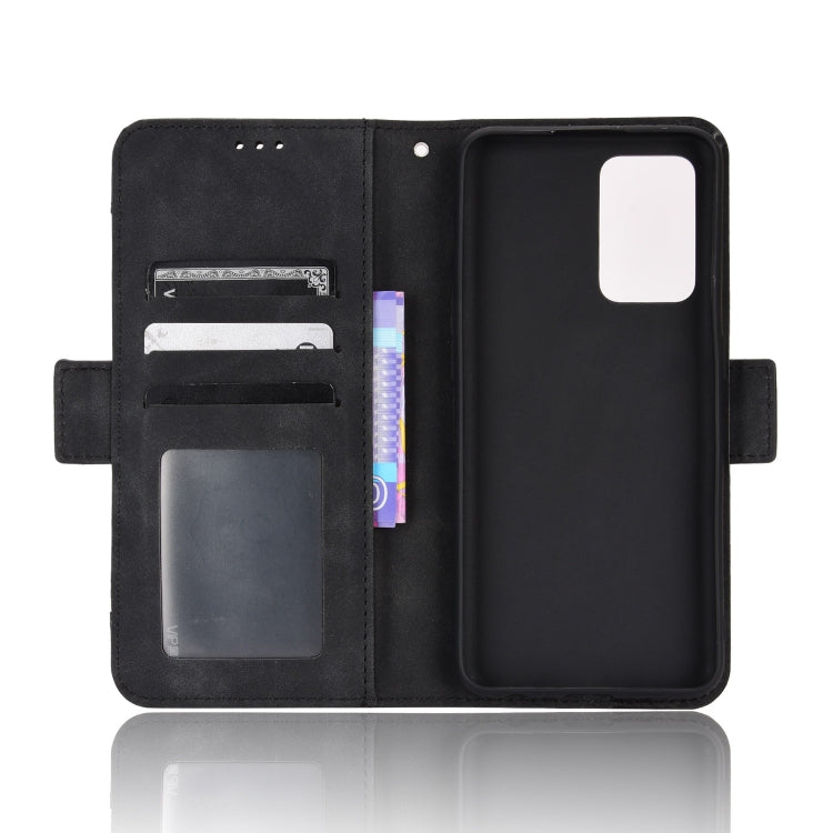 For OPPO Reno7 5G / Find X5 Lite Skin Feel Calf Pattern Leather Phone Case