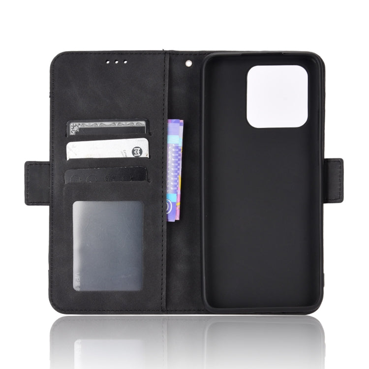 For Xiaomi Redmi 10C Skin Feel Calf Pattern Leather Phone Case