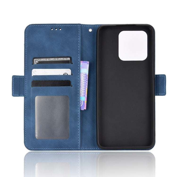 For Xiaomi Redmi 10C Skin Feel Calf Pattern Leather Phone Case