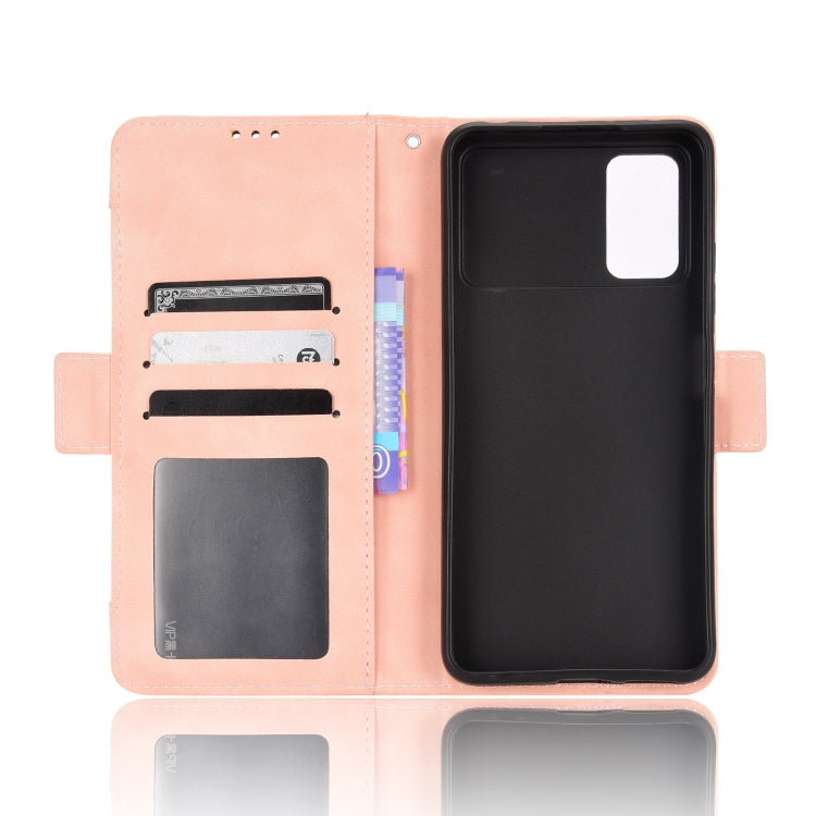 For Xiaomi Poco M4 Pro 5G Skin Feel Calf Pattern Leather Phone Case
