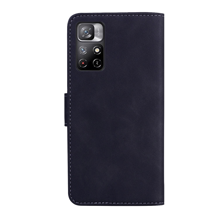 For Xiaomi Redmi Note 11 Skin Feel Pure Color Flip Leather Phone Case