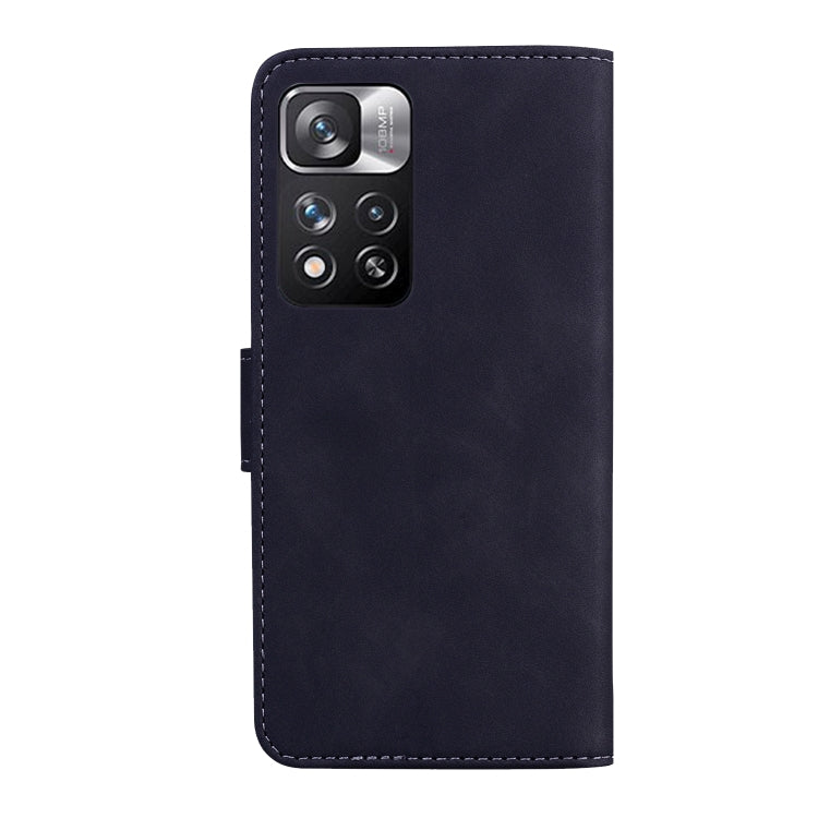 For Xiaomi Redmi Note 11 Pro / Note 11 Pro+ 5G Skin Feel Pure Color Flip Leather Phone Case