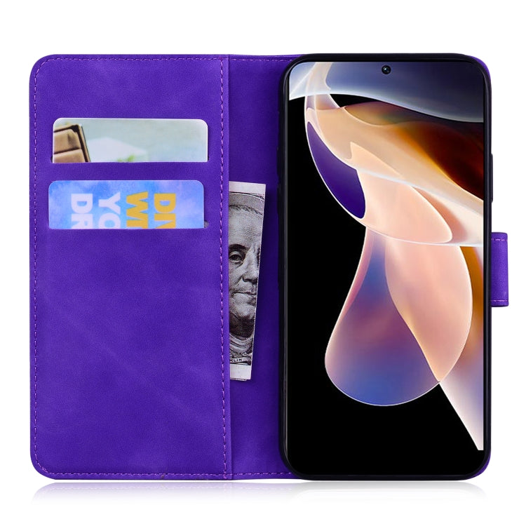 For Xiaomi Redmi Note 11 Pro / Note 11 Pro+ 5G Skin Feel Pure Color Flip Leather Phone Case