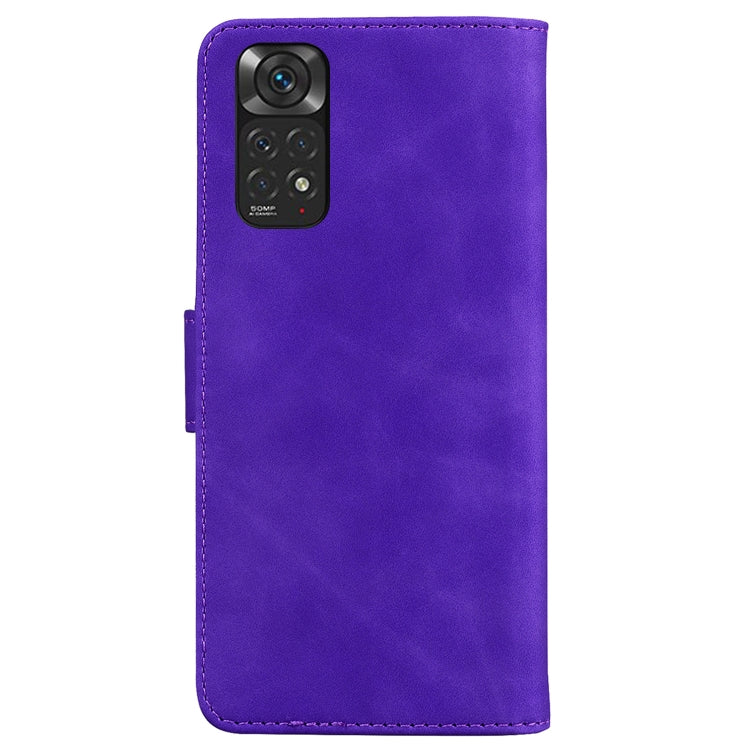 For Xiaomi Redmi Note 11 Global / Note 11S Skin Feel Pure Color Flip Leather Phone Case