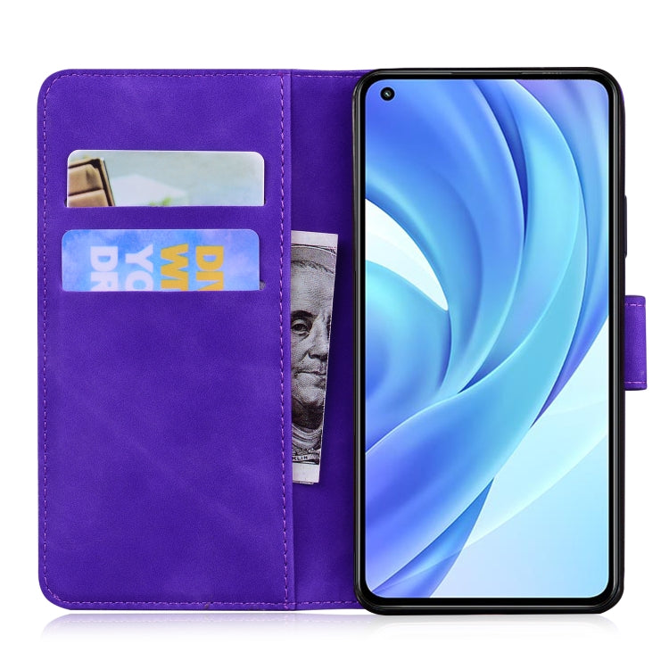 For Xiaomi Mi 11 Lite Skin Feel Pure Color Flip Leather Phone Case