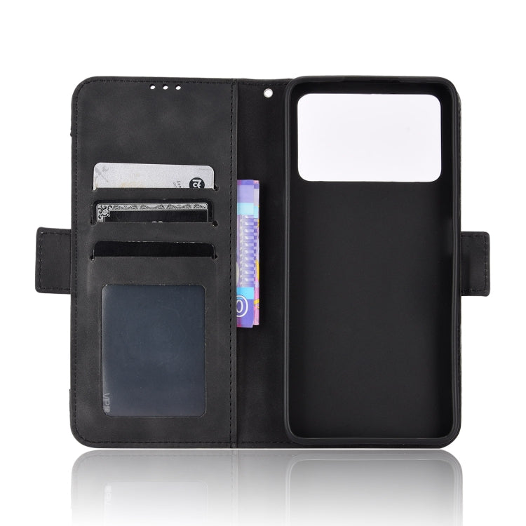 For Xiaomi Poco M4 Pro 4G Skin Feel Calf Pattern Leather Phone Case