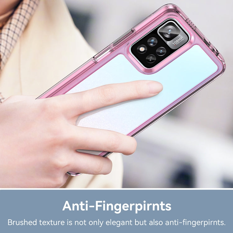 For Xiaomi Poco X4 NFC 5G Colorful Series Acrylic + TPU Phone Case