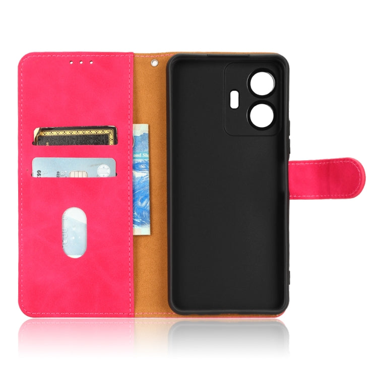 For vivo Y77 Global Skin Feel Magnetic Flip Leather Phone Case