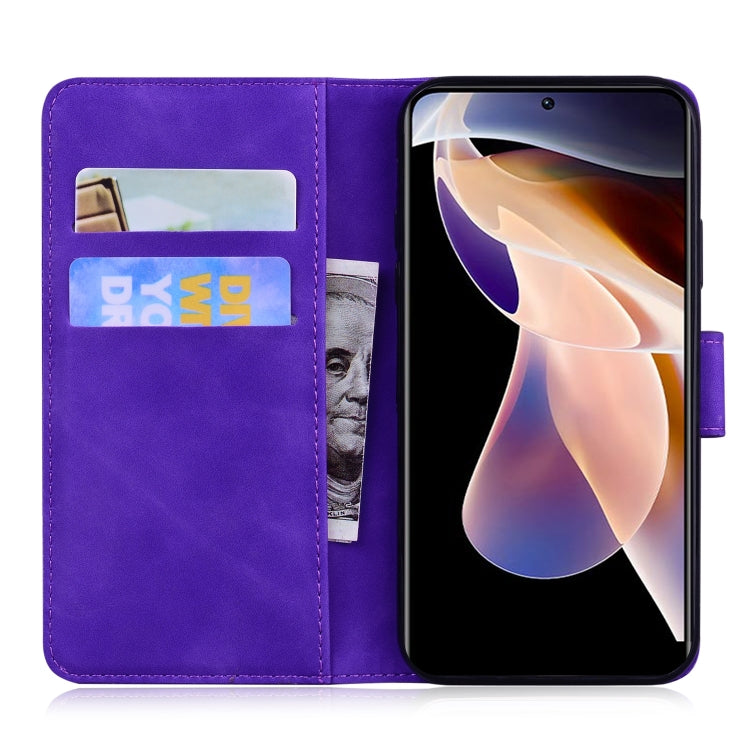 For Xiaomi Redmi 11 Prime 4G Skin Feel Pure Color Flip Leather Phone Case