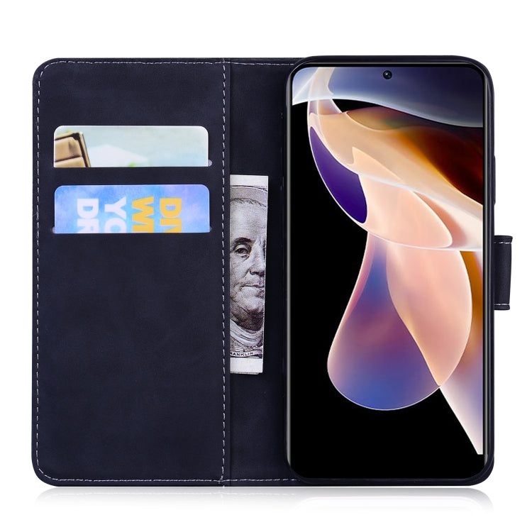 For Xiaomi Redmi 11 Prime 4G Skin Feel Pure Color Flip Leather Phone Case