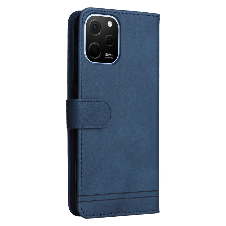 For Huawei nova Y61 Skin Feel Life Tree Metal Button Leather Phone Case