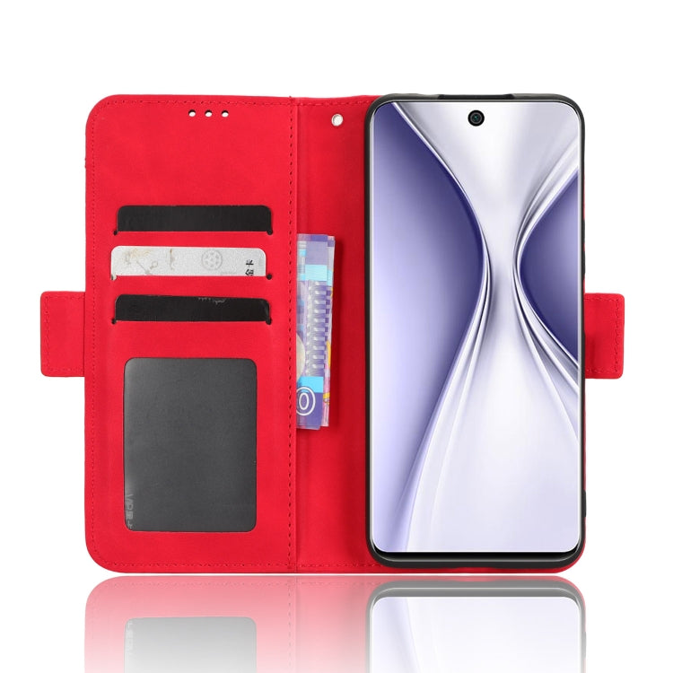 For Honor X20 SE / Huawei nova 10z Skin Feel Calf Texture Card Slots Leather Phone Case