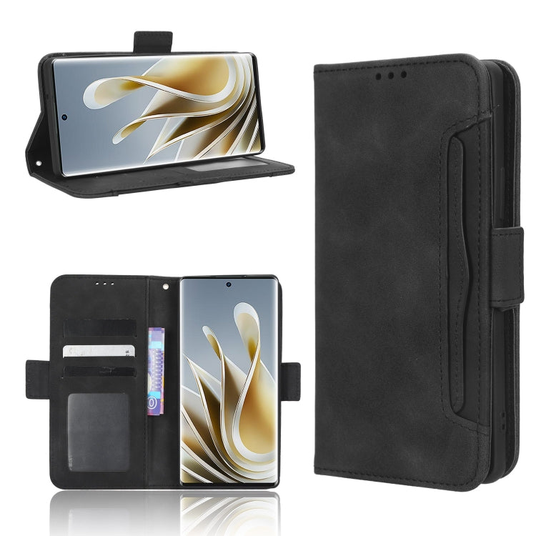 For ZTE nubia Z50 Skin Feel Calf Texture Card Slots Leather Phone Case