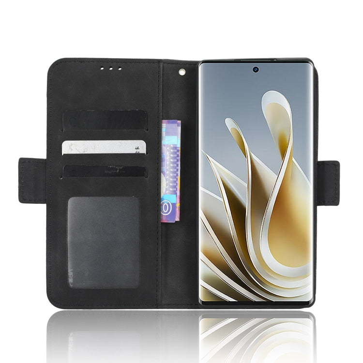 For ZTE nubia Z50 Skin Feel Calf Texture Card Slots Leather Phone Case