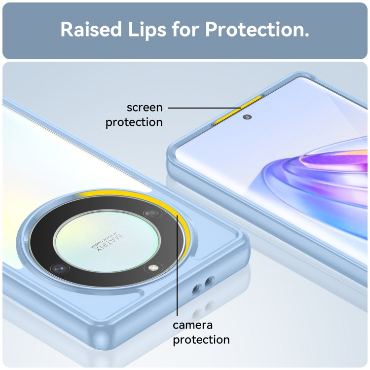 For Honor X9A Colorful Series Acrylic + TPU Phone Case