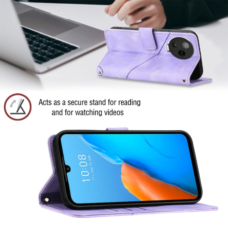 For Infinix Note 12 Pro 4G Skin-feel Embossed Leather Phone Case