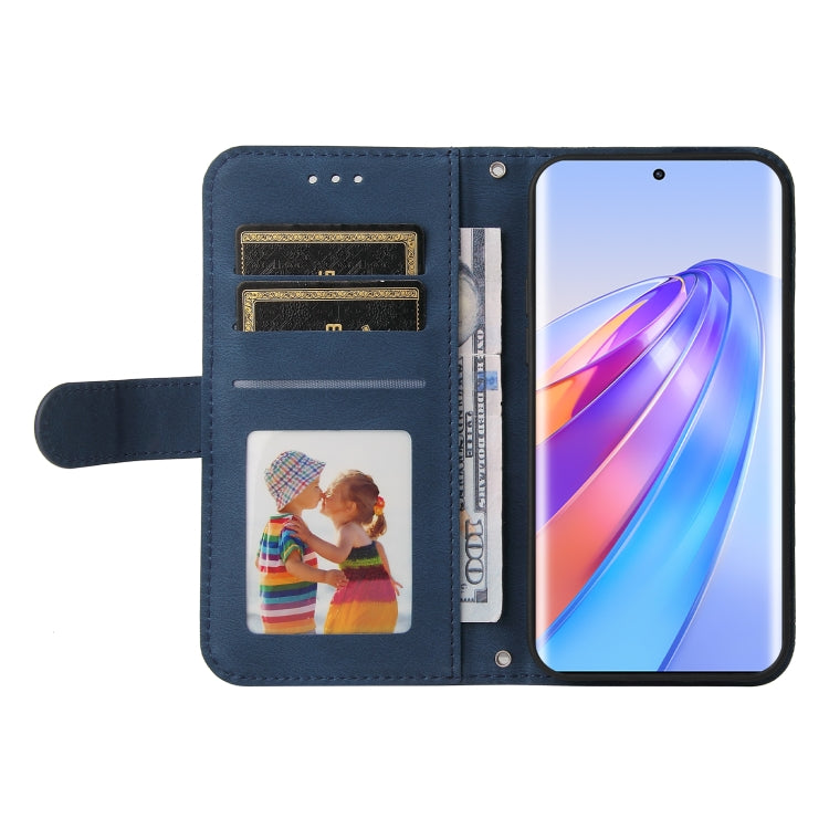 For Honor X9a/X40 5G/Magic5 Lite Skin Feel Life Tree Metal Button Leather Phone Case