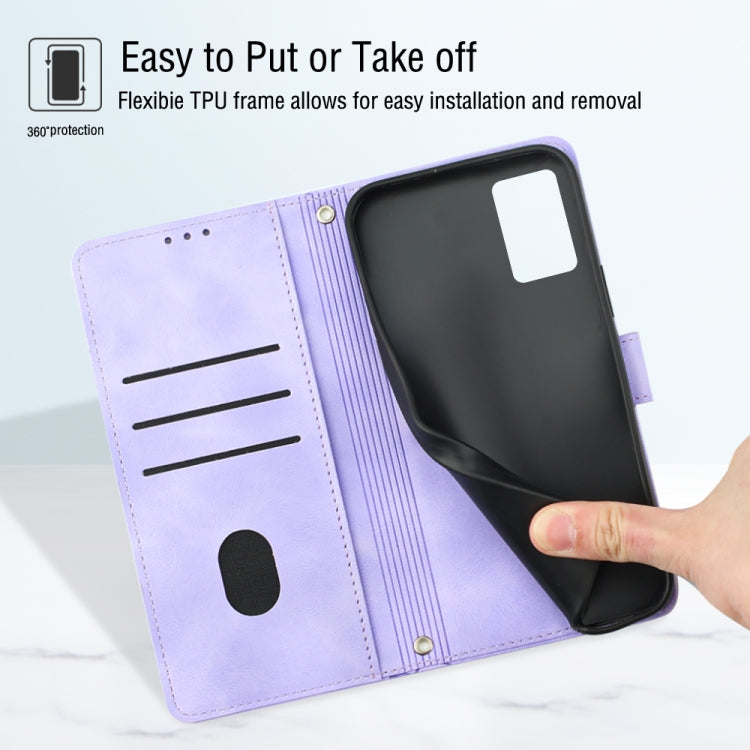 For OPPO A96 4G / A36 / A76 / Realme 9i Skin-feel Embossed Leather Phone Case