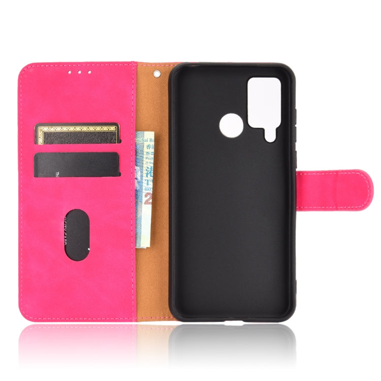 For DOOGEE N20 Pro Solid Color Skin Feel Magnetic Buckle Horizontal Flip Calf Texture PU Leather Case with Holder & Card Slots & Wallet