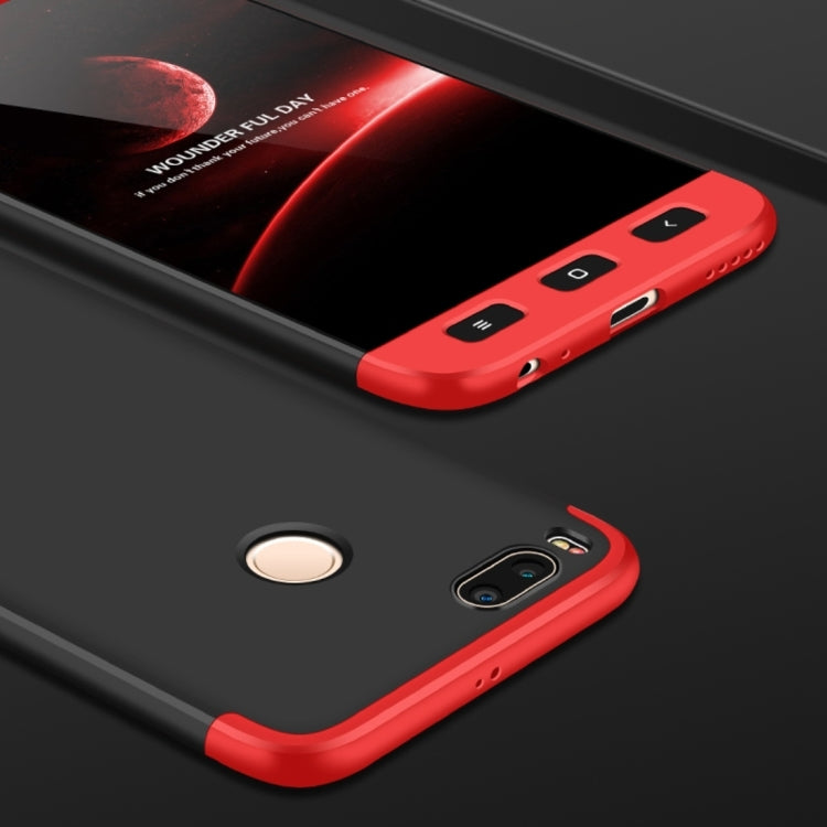 GKK Xiaomi Mi 5X / A1 PC 360 Degrees Full Coverage Protective Case Back Cover