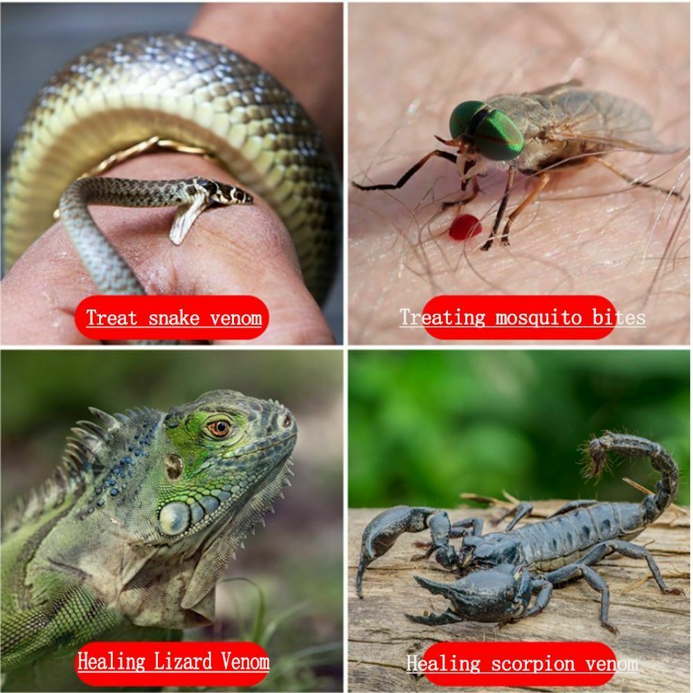 Bite Kit Suction Tool Mosquito Bite Sucker Bug Bite Thing Bug Bite Itch Relief