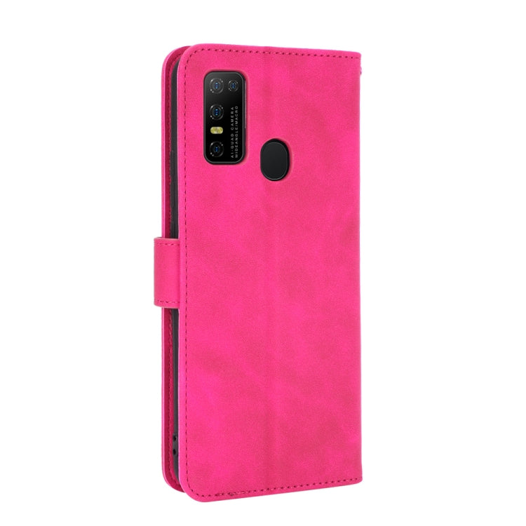 For DOOGEE N30 Solid Color Skin Feel Magnetic Buckle Horizontal Flip Calf Texture PU Leather Case with Holder & Card Slots & Wallet