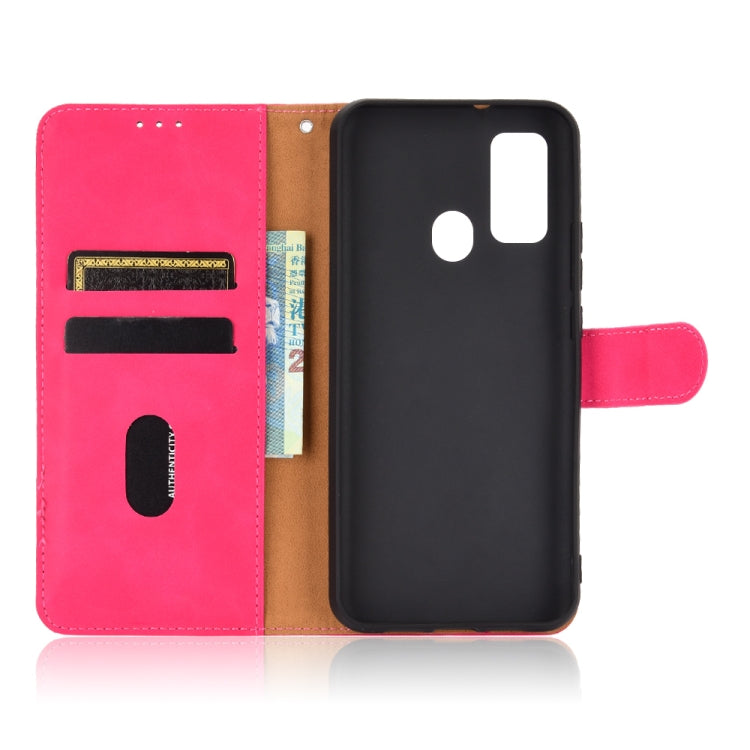 For DOOGEE N30 Solid Color Skin Feel Magnetic Buckle Horizontal Flip Calf Texture PU Leather Case with Holder & Card Slots & Wallet