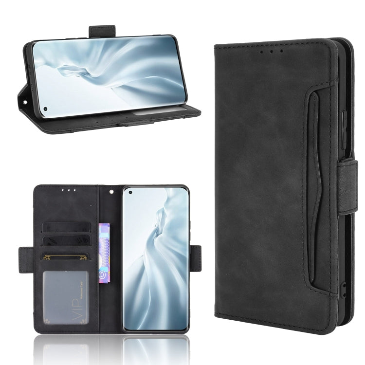 For Xiaomi Mi 11 Skin Feel Calf Pattern Horizontal Flip Leather Case with Holder & Card Slots & Photo Frame