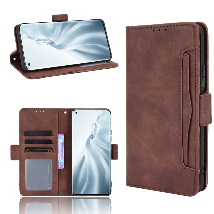 For Xiaomi Mi 11 Skin Feel Calf Pattern Horizontal Flip Leather Case with Holder & Card Slots & Photo Frame