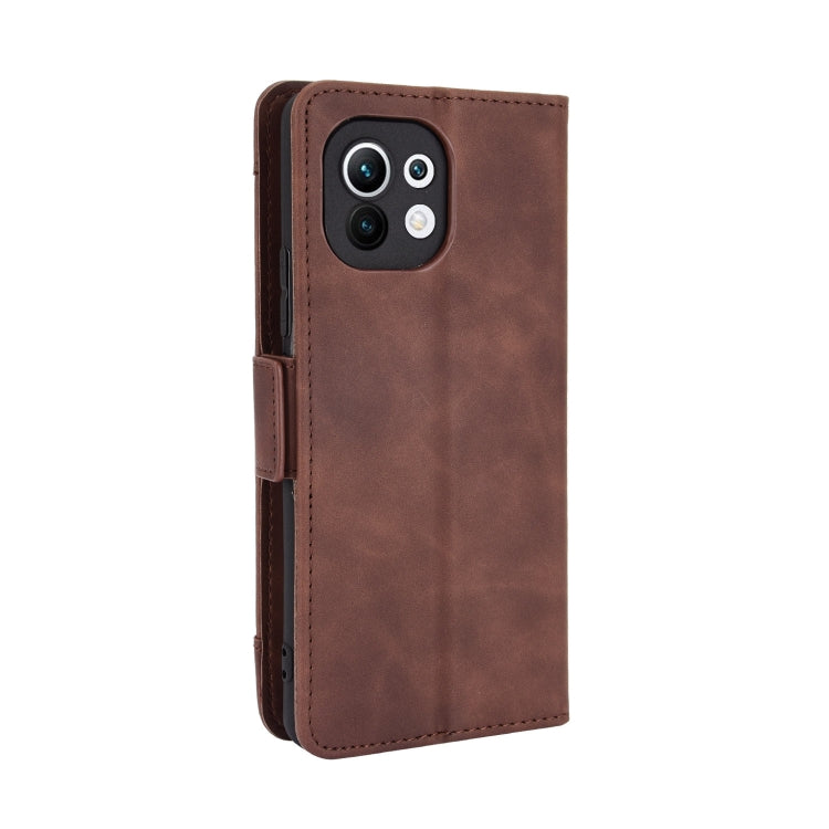 For Xiaomi Mi 11 Skin Feel Calf Pattern Horizontal Flip Leather Case with Holder & Card Slots & Photo Frame