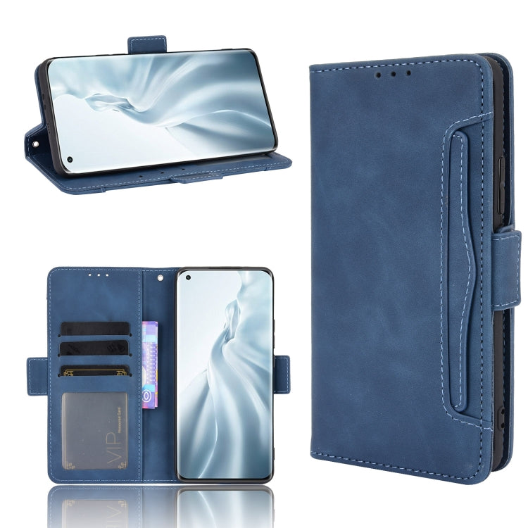 For Xiaomi Mi 11 Skin Feel Calf Pattern Horizontal Flip Leather Case with Holder & Card Slots & Photo Frame