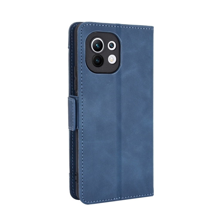 For Xiaomi Mi 11 Skin Feel Calf Pattern Horizontal Flip Leather Case with Holder & Card Slots & Photo Frame