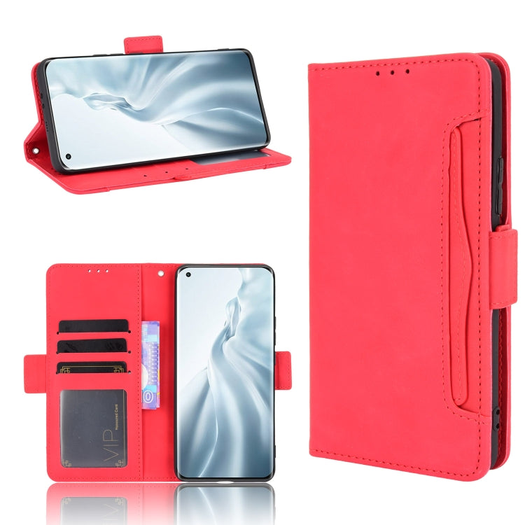 For Xiaomi Mi 11 Skin Feel Calf Pattern Horizontal Flip Leather Case with Holder & Card Slots & Photo Frame