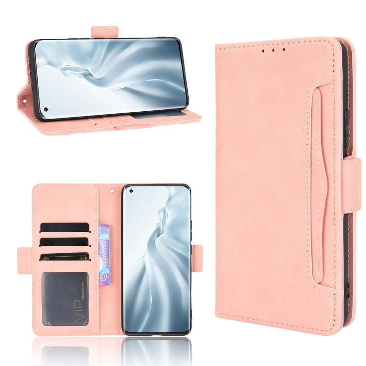 For Xiaomi Mi 11 Skin Feel Calf Pattern Horizontal Flip Leather Case with Holder & Card Slots & Photo Frame