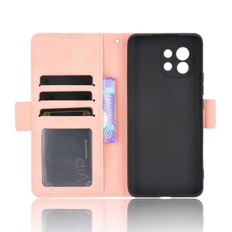 For Xiaomi Mi 11 Skin Feel Calf Pattern Horizontal Flip Leather Case with Holder & Card Slots & Photo Frame